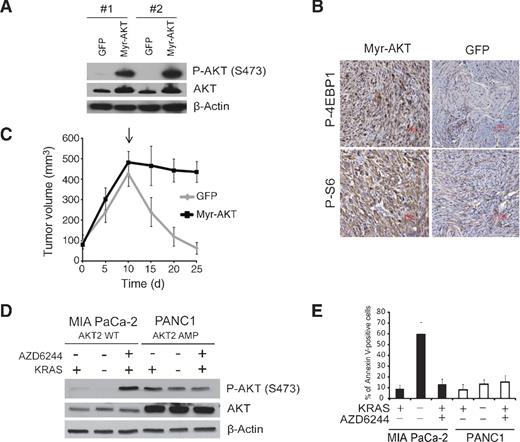 Figure 6. A, phospho-AKT and AKT levels of iKRAS cells transduced with lentivirus encoding myristilated-AKT (Myr-AKT). B, representative IHC of P-S6 or P-4EBP1 in allografts of iKRAS cells expressing GFP or Myr-AKT collected 5 days after doxycycline withdrawal (KRASG12D ablated). C, tumor volumes from allografts of iKRAS cells expressing GFP or Myr-AKT. Arrow, time point of doxycycline withdrawal. D, phospho-AKT and AKT levels of MIA PaCa-2 (KRASG12C and AKT2wt) and PANC1 (KRASG12D AKT2amp) cells transduced with a doxycycline-inducible shRNA for KRAS and cultured for 72 hours in the absence of doxycycline (KRAS+) with our without treatment with AZD6244 2 μmol/L, or in the presence of doxycycline (KRAS−). E, quantification of apoptotic cells in MIA PaCa-2 and PANC1 cells transduced with doxycycline-inducible shRNA for KRAS cultured for 72 hours in the absence of doxycycline (KRAS+) with or without treatment with AZD6244 2 μmol/L, or in the presence of doxycycline (KRAS−).