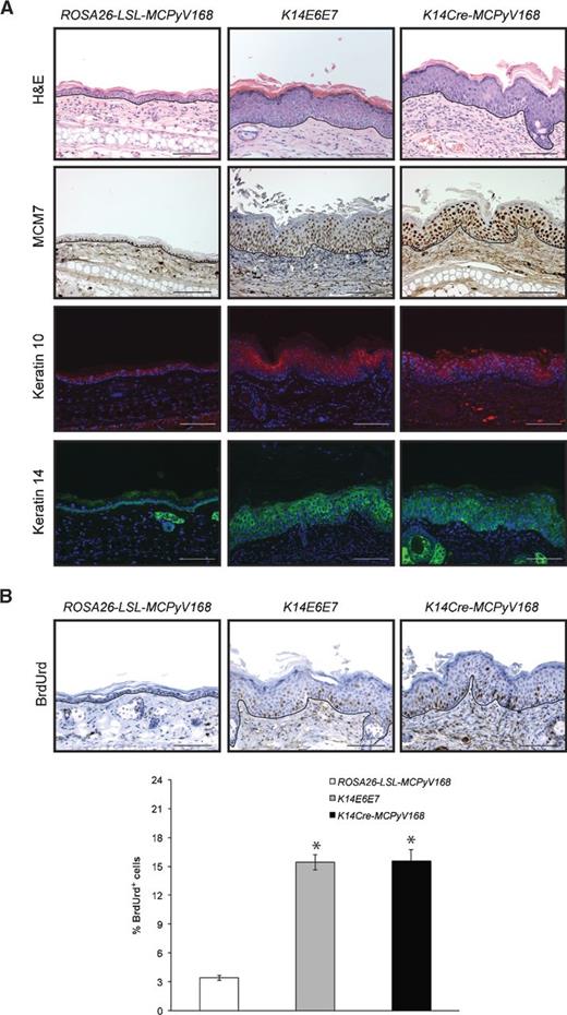 Figure 3. Histologic and biomarker analysis of the K14Cre-MCPyV168 stratified epithelium. A, stratified epithelium of the ear harvested from ROSA26-LSL-MCPyV168 (left), K14E6E7 (middle), and K14Cre-MCPyV168 (right) mice. Tissue was subjected to H&E staining, IHC analysis for MCM7, and immunofluorescent staining for keratin 10 (AF594; red) and keratin 14 (AF594; pseudocolored green). DAPI was used to counterstain cellular nuclei. B, representative images of BrdUrd IHC on ear epithelium from ROSA26-LSL-MCPyV168 (left), K14E6E7 (middle), and K14Cre-MCPyV168 (right) mice. Quantification of the total percentage of BrdUrd-positive cells is shown in the bar graph. The total percentage of BrdUrd-positive cells was calculated using representative samples from groups of ROSA26-LSL-MCPyV168 (n = 3), K14E6E7 (n = 5), and K14Cre-MCPyV168 (n = 5) mice. Error bars, SD. *, P < 0.05 using a two-sided Wilcoxon rank-sum test. A black line is used to highlight the basement membrane. Scale bars, 100 μm.