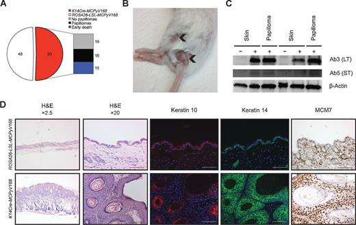 Figure 4. K14Cre-MCPyV168 mice on FVB/N background spontaneously develop papillomas. A, incidence of wart formation on K14Cre-MCPyV168 mice. As a result of breeding ROSA26-LSL-MCPyV168 and K14Cre mice, 50 out of 98 total mice were positive for Cre recombinase (K14Cre-MCPyV168; red segment of pie chart). Of these K14Cre-MCPyV168 mice, 15 of 50 mice died before weaning (30%; blue portion of bar graph). Of the surviving K14Cre-MCPyV168 mice, 16 of 35 spontaneously developed papillomas (45.7%; black portion of bar graph). B, representative image of papillomas arising on the flank and skin surrounding the base of the tail on a K14Cre-MCPyV168 mouse indicated by arrowheads. C, immunoblot analysis of whole tissue protein lysates isolated from the skin of two independent ROSA26-LSL-MCPyV168 mice and autologous skin and papilloma samples from two independent K14Cre-MCPyV168 mice. Total protein levels were detected using antibodies to MCPyV LT, MCPyV ST, and β-actin as a loading control. +, K14Cre-MCPyV168 mice positive for Cre recombinase; −, Cre-negative ROSA26-LSL-MCPyV168 control mice. D, histologic and biomarker analysis of a papilloma harvested from the skin of a K14Cre-MCPyV168 mouse and age/location-matched tissue from a control ROSA26-LSL-MCPyV168 mouse. Representative images of H&E, coimmunofluorescence analysis of keratin 10 (AF594; red) and keratin 14 (AF488; green), and MCM7 IHC are shown. DAPI was used to counterstain cellular nuclei. Scale bars, 100 μm.