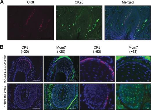 Figure 6. Merkel cells are positive for MCM7 in K14Cre-MCPyV168 mice. A, immunofluorescence analysis showing colocalization of cytokeratin 8 (CK8) and cytokeratin 20 (CK20) in Merkel cells. Tissue sections of whisker pads harvested from K14Cre-MCPyV168 adult mice were analyzed by coimmunofluorescence staining for CK8 (AF647; pink) and CK20 (AF488; green). DAPI was used to counterstain cellular nuclei. Microscopic images were taken of the whisker vibrissae to highlight Merkel cells along the vibrissae follicle. B, sequential sections of whisker pad tissue harvested from ROSA26-LSL-MCPyV168 and K14Cre-MCPyV168 adult mice were analyzed by immunofluorescence for CK8 (AF647; pink) and MCM7 (AF488; green). Scale bars in ×20 images, 100 μm; scale bars in ×63 images, 10 μm.