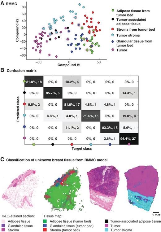 Figure 2. Differentiation of tissues present in tumor and tumor bed samples based on the metabolomic profiles measured with DESI MSI. A, 10-fold cross-validated RMMC score plot (each patient is maximally represented by one point in each group; for each point maximum, 100 randomly selected spectra were averaged) showing the separation of the groups using multivariate analysis. B, confusion matrix showing classification results based on mahalanobis distance (83.8% overall correct assignment). C, comparison of H&E–stained tissue section (stained after DESI MSI) used for histologic evaluation and tissue classification results from multivariate statistical analysis of the DESI MSI metabolomic data. Colored pixels correspond to tissues as indicated in the Figure legend. Left, a tumor bed biopsy. Right, a grade 3 IDC with negative HR status.