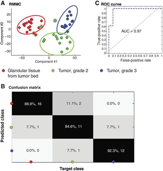 Figure 3. Association of metabolomic DESI MSI profiles of normal glandular and tumor (ILC and IDC) tissue with tumor grade. A, 10-fold cross-validated RMMC score plot (each patient is maximally represented by one point in each group; for each point maximum, 100 randomly selected spectra were averaged) showing the separation of normal glandular tissue, grade 2 tumors, and grade 3 tumors using multivariate data analysis. B, confusion matrix of the RMMC model showing classification results based on mahalanobis distance (88.6% overall correct assignment). C, ROC curve showing the potential of the model to discriminate between grade 2 tumors and grade 3 tumors.