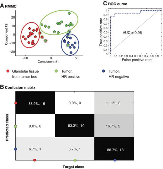 Figure 4. Association of metabolomic DESI MSI profiles of normal glandular and tumor tissue with hormone receptor status. A, 10-fold cross-validated RMMC score plot (each patient is maximally represented by one point in each group; for each point maximum, 100 randomly selected spectra were averaged) showing the separation of normal glandular tissue, tumors with positive HR status (ER/PR receptor positive), and tumors with negative HR status (ER/PR receptor negative) using multivariate data analysis. B, confusion matrix showing classification results based on mahalanobis distance (86.7% overall correct assignment). C, ROC curve showing the potential of the model to discriminate between positive and negative HR status.