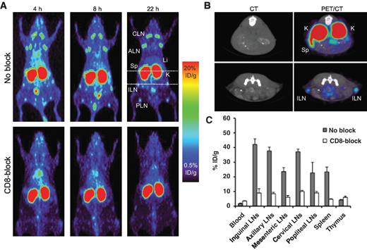 Figure 2. Anti-CD8 micro-PET of 89Zr-malDFO-169 cDb in wild-type and CD8-blocked AKR mice. A, 89Zr-malDFO-169 cDb was injected into wild-type (top) and CD8-blocked (bolus 3 mg/kg GK1.4 cDb; bottom) AKR mice and imaged at 4, 8, and 22 hours after injection. Images are represented as 25 mm maximum intensity projections. B, transverse CT and PET/CT images indicated with dashed white bars show specific targeting to the spleen and lymph nodes of wild-type AKR mice. C, ex vivo biodistribution at 22 hours after injection of 89Zr-malDFO-169 cDb from wild-type and CD8-blocked AKR mice (n = 3 per group). CLN, cervical lymph node; ALN, axillary lymph node; Li, liver; Sp, spleen; K, kidney; ILN, inguinal lymph node; PLN, popliteal lymph node.