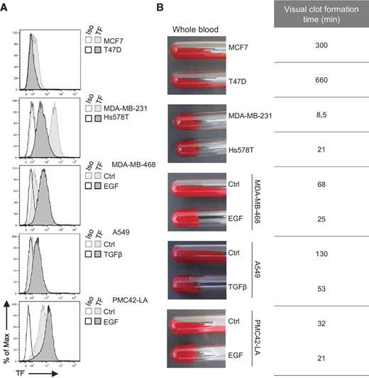 Figure 2. Cell surface TF expression and procoagulant activity of EMT+ and EMT− cell lines. A, flow cytometry analyses of surface TF expression in EMT− and EMT+ cell lines and in inducible cell lines [not treated (Ctrl) or treated with EGF or TGFβ]. A corresponding isotype antibody was used as a labeling control. B, clot assays performed by incubating 10 × 103 cells with whole blood of healthy donors. Photographs were taken at a time that discriminated EMT+ and EMT− cells.