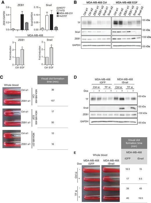 Figure 3. Regulation of TF by EMT transcription factors. A, qRT-PCR analyses of ZEB1 and Snail in EMT− and EMT+ cell lines and in MDA-MB-468 cells not treated (Ctrl) or treated with EGF. *, P < 0.05. B, Western blotting analyses of TF, Snail, and ZEB1 in MDA-MB-468 treated or not with EGF and transfected with two nontargeting siRNA (Ctrl si1 or Ctrl si2), two siRNA against ZEB1 (ZEB1 si1 or ZEB1 si2), or two siRNA against Snail (Snail si1 or Snail si2). C, clot assays performed with whole blood of healthy donors incubated with MDA-MB-468 (treated or not with EGF) and MDA-MB-231 transfected with Ctrl si1 or ZEB1 si1. D, Western blotting analyses of TF, Snail, and ZEB1. E, clot assays performed with whole blood of healthy donors incubated with MDA-MB-468 iGFP or iSnail treated or not with doxycycline (Dox) for 120 hours and transfected with Ctrl siRNA or TF siRNA.