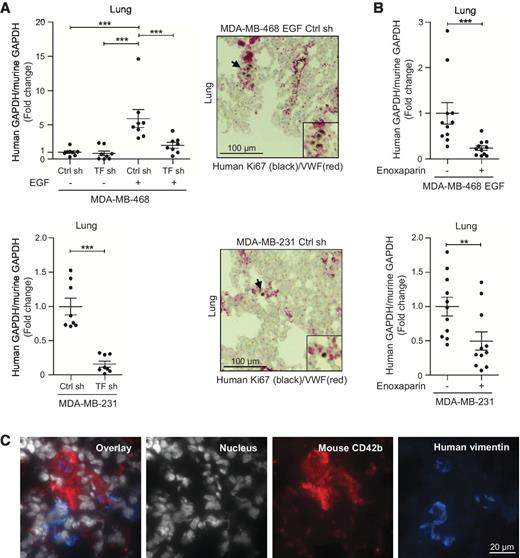 Figure 4. Impact of TF and coagulation on CTC persistence in mouse models. A, RT-nested qPCR for human GAPDH performed on total RNA extracted from lungs of BALB/c mice injected intravenously with MDA-MB-468 cells (treated or not with EGF; n = 8, top) or MDA-MB-231 (n = 8, bottom) transduced with Ctrl shRNA or TF shRNA and collected 24 hours after injection. Double IHC against human Ki67 (black) and mouse VWF (red) performed on lung sections from mice injected with the EGF-treated MDA-MB-468 group (top) or Ctrl shRNA MDA-MB-231 group (bottom). B, RT-nested qPCR for human GAPDH performed on total RNA extracted from the lungs of BALB/c mice treated or not with 10 mg/kg of enoxaparin 1 hour before intravenous injection of EGF-treated MDA-MB-468 cells (n = 11, top) or MDA-MB-231 (n = 11, bottom). **, P < 0.01; ***, P < 0.001. C, double immunofluorescence against human vimentin (blue) and mouse CD42b (platelets, red) performed on frozen lung sections from immunodeficient mice injected with MDA-MB-231 and collected 24 hours after injection. Nuclei were labeled with TO-PRO-3 (white).