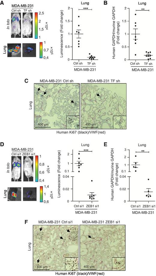 Figure 6. Metastasis formation in SCID mice injected with MDA-MB-231 silenced for TF (A–C) or ZEB1 (D–F) expression. A and D, In vivo imaging analyses of SCID mice injected intravenously with MDA-MB-231 cells 3–5 weeks after injections, and of collected lungs (n = 7). B and E, RT-nested qPCR for human GAPDH performed on total RNA extracted from lungs (n = 7 for B and n = 5 for E). **, P < 0.01; ***, P < 0.001. C and F, double IHC against human Ki67 (black) and mouse VWF (red) performed on lung sections. Arrows, metastatic foci.