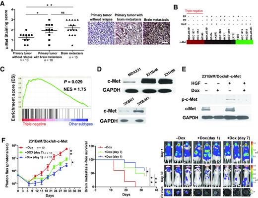 Figure 2. c-Met is highly expressed in triple-negative breast cancer cells and promotes brain metastasis in vivo. A, immunohistochemical quantification of c-Met protein expressions in samples from primary tumors with or without brain metastases and samples derived from brain metastatic lesions (left). Right, representative photos of c-Met staining. Scale bars, 50 μm. B, heatmap analysis of c-Met expression in different subtypes of breast cancer cell lines using the GSE10843 database. C, GSEA enrichment chart of c-Met signature genes between triple-negative breast cancer patients (n = 140) and patients with other subtypes (n = 570). D, anti-c-Met Western blot analysis for c-Met of brain metastatic cells and their parental cells. E, Western blot analyses for total and phospho c-Met proteins in 231BrM/Dox/sh-c-Met cells that were treated with or without HGF (20 ng/mL) and doxycycline (1 μg/mL). F, 231BrM/Dox/sh-c-Met (2 × 105 cells) were intracardially injected into nude mice (n = 10) followed by giving them with doxycycline in drinking water at different time points (day 1 or day 7). Left, total photon flux of brain metastatic lesions was measured by BLI at the time indicated. Middle, Kaplan–Meier analysis for brain metastasis-free survival of mice fed with the indicated water. Right, BLI images of brain metastatic lesions of three representative mice from each experimental group.