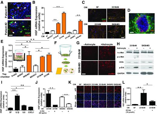Figure 6. c-Met–induced IL1β enhances HGF secretion from TAAs. A, immunocytochemical analysis of GFAP and phospho-c-Met expression in brain metastatic lesions from breast cancer patients. B, mRNA expression of HGF was measured in human normal astrocytes that were treated with the indicated conditioned medium from breast cancer cells. C, immunocytochemical analysis of GFAP and HGF expression in human normal astrocytes that were treated with the conditioned medium derived from brain metastatic cells. D, immunocytochemical analysis of GFAP and HGF expression for a brain metastatic lesion from a mouse inoculated with 231BrM cells. E, HGF expressions in human normal astrocytes with or without coculturing cancer cells were measured by qRT-PCR. Cancer cells were seeded in the upper chamber of a Transwell until they become confluent followed by coculturing with human normal astrocytes in the bottom chamber for 48 hours (inset). F, a cartoon showing preparation of the cancer cells for immunocytochemical analysis from the Transwell membrane. G, immunocytochemical analysis of c-Met phosphorylation in cancer cells that were cocultured with or without astrocytes as illustrated in F. H, the cancer cells grown on the Transwell membrane were collected and subjected to Western blot analyses with the indicated antibodies. I, mRNA levels of HGF in human normal astrocytes that were treated with the indicated recombinant proteins were measured by qRT-PCR after 48 hours of incubation. J, human normal astrocytes were treated with the indicated conditioned medium in the presence or absence of IL1RA (20 μg/mL) for 48 hours followed by measuring the mRNA levels of HGF by qRT-PCR. K, immunocytochemical analyses for nuclear localization of the p65 protein in human normal astrocytes that were treated with the indicated conditioned medium. L, human normal astrocytes were treated with 231BrM conditioned medium with or without the addition of the NF-κB inhibitor PF-184 for 48 hours followed by measuring the mRNA levels of HGF. Scale bars, 100 μm (A, C, D), 200 μm (G).