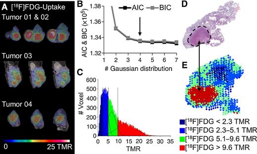 Figure 1. Voxelwise analysis approach for [18F]FDG-PET. A, [18F]FDG-PET/MRI serial slides of four tumors. Voxel data of 18 tumors was examined. A four Gaussian distribution was the best fit according to AIC and BIC (B) and was applied to the summed histogram with the thresholds TMR = 2.3, 5.1, and 9.6 (C). H&E histology (D) compared to a parametric color map of the in vivo data (E).