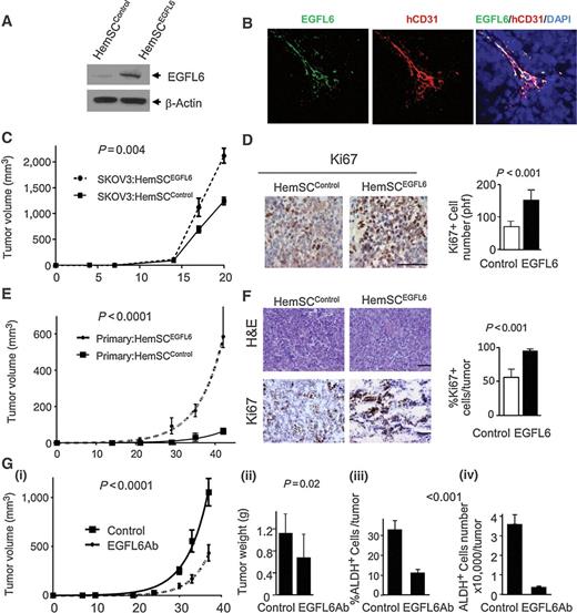 Figure 6. Vascular EGFL6 promotes tumor growth. A, EGFL6 Western of control and EGFL6-lentivirally transduced infantile hemangioma stem cells (HemSCEGFL6). B, coimmunofluorescence of human CD31 (hCD31) and EGFL6 in tumor vessels in SKOV3:HemSCEGFL6 tumor xenografts. C, tumor growth curves of SKOV3:HemSCEGFL6 tumors vs. SKOV3:HemSCControl tumors (n = 10/group in two independent experiments). D, IHC analysis of Ki67 expression in EGFL6-expressing vs. control tumors. E, tumor growth curves of freshly isolated primary patient cells coinjected with HemSCEGFL6 or HemSCControl (n = 4 patients with two tumors each). F, hematoxylin and eosin staining and Ki67 IHC of tumors generated with primary patient cells coinjected with HemSCEGFL6 or HemSCControl (n = 6/group). G, tumor growth curve (i), weights (ii), ALDH+ cell percentage (iii), and absolute cell number (iv) for control and anti–EGFL6-treated SKOV3 (non–EGFL6-expressing cells) flank tumors (n = 10/group in two separate experiments). Error bars, SDs.