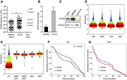 Figure 1. SOX9 is upregulated in human gastric cancer. A, SOX9 in cancer and healthy gastric-paired samples and in gastric cancer cell lines. 1.5-fold higher was the threshold for overexpression B, SOX9 mRNA levels in gastric cancer relative to gastric tissue (n = 76). C, Western blot analysis of SOX9 expression in indicated cell lines. D, violin plots of over 2-fold upregulated genes in relation to control tissue across the TCGA-defined gastric cell subtypes. Mean and median global expression values are shown as red crosses and green squares, respectively, with SOX9 levels indicated by red circles. E, violin plots of genes upregulated over 2-fold within the complete ACRG cohort (All) and the four subtypes according to the ACRG classification (SOX9 in red circle). F and G, Kaplan–Meier curves for the ACRG patient overall survival (OS) and disease-free survival (DFS) rates based on SOX9 expression. Log-rank test, P = 0.015.