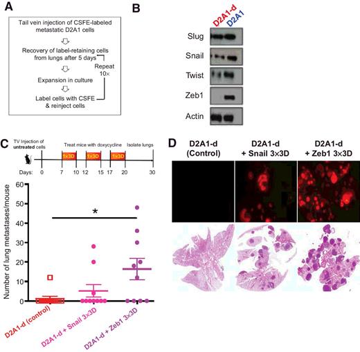 Figure 1. Zeb1 expression is sufficient to awaken latent DTCs. A, Schematic of in vivo strategy. B, Western blot analysis for D2A1-d and parental D2A1 cell lines. C, Schematic of in vivo strategy. TV, tail vein. Quantification of lung metastases using fluorescent dissection microscope at ×0.8 magnification. Data, mean ± SEM; n = 10. *, P < 0.02 by Student t test. D, Representative fluorescent images of whole lungs and hematoxylin and eosin staining of histologic sections.