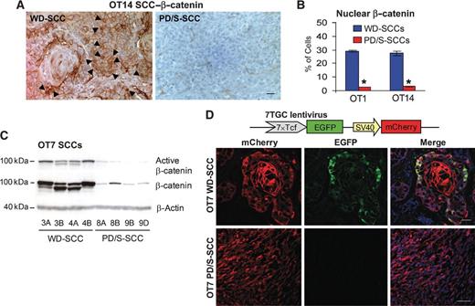 Figure 3. β-Catenin signaling is attenuated during late stages of SCC progression. A, β-catenin cell localization by IHC assays. Arrowheads, cells with β-catenin at nuclei. Scale bar, 30 μm. B, quantification of cells (mean ± SE; three samples per group) with β-catenin at nuclei in WD-SCCs and PD/S-SCCs of the indicated lineage. C, levels of β-catenin and its active form in WD-SCCs and PD/S-SCCs. β-Actin was used as a protein-loading control. Sample number identifies tumor passage and letters indicate independent tumor replicates. D, top, schema of the construct used to determine β-catenin transcriptional activity; bottom, representative images showing transduced cells (red) and cells with induced β-catenin signaling (green cells) in WD-SCCs and PD/S-SCCs. Scale bar, 30 μm.