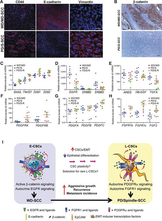 Figure 7. Advanced human skin SCCs with induced EMT recapitulate the changes in signaling pathways described in mouse PD/S-SCCs. A, representative images showing an expanded CD44+ cell population, lower E-cadherin, and higher vimentin expression levels in PD/S-SCCs compared with WD/MD-SCCs. Scale bar, 30 μm. B, β-catenin expression and cell localization in WD/MD-SCC and PD/S-SCCs. Scale bar, 20 μm. C–H, quantification of the indicated mRNAs in a set of human WD/MD-SCCs and PD/S-SCCs. Mean (±SE) mRNA levels of these genes relative to GAPDH mRNA are shown (individual data and mean ± SE). Green dots, recurrent PD/S-SCCs. I, schema describing the identified changes in CSC features and regulatory mechanisms at different stages of mouse SCC progression.