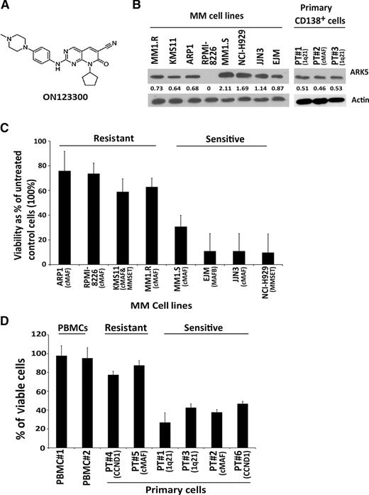 Figure 1. Anti–multiple myeloma activity of ON123300, a multitargeted kinase inhibitor. A, structure of ON123300- 8-Cyclopentyl-2-[4-(4-methyl-piperazin-1-yl)- phenylamino]-7-oxo-7,8-dihydro-pyrido[2,3-d]pyrimidine-6- carbonitrile. B, ARK5 protein expression was confirmed by Western blot in multiple myeloma (MM) cell lines and primary cells. ARK5 level was significantly higher in the cell lines MM1.S, NCI-H929, JJN3, EJM, and in primary samples with 1q21 deletion and cMAF translocation. The numerical values indicate densitometric analysis of band intensity using ImageJ. C, ON123300 decreased cell viability by approximately 30% to 70% (IC50, 50–200 nmol/L) in 8/8 multiple myeloma cell lines examined. On the basis of IC50 of 50 nmol/L, we could separate the cell lines into two groups: four cell lines (MM.1R, KMS11, RPMI-8226, and ARP1) had IC50 of 50–150 nmol/L, and four cell lines (MM1.S, EJM, JJN3, and NCI-H929) were very sensitive (IC50 < 50 nmol/L). D, purified CD138+ patient multiple myeloma cells from six patients were treated with ON123300 at 50 nmol/L concentration for 48 hours, followed by assessment of viability using CellTiter-Blue assay. PBMCs from healthy donors treated with ON123300 for 48 hours showed no change in the cell viability, whereas there was a significant decrease in cell viability in primary multiple myeloma cells and in both cell lines.