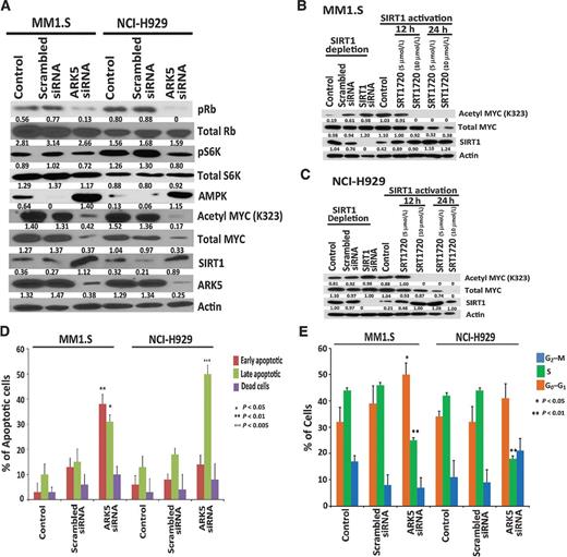 Figure 3. ARK5 depletion inhibits multiple myeloma cell growth via Rb/mTOR/MYC pathways and induces apoptosis and cell-cycle arrest. A, ARK5 repression significantly attenuated phosphoS6K, phosphoRb, MYC, and acetyl MYC activities in multiple myeloma. Conversely, depletion of ARK5 increased AMPK and SIRT1. Western blot analysis showing the levels of ARK5, SIRT1, MYC, acetyl MYC, total S6K, Rb, phosphoS6K, and phosphoRb proteins after 24-hour transfection in MM1.S and NCI-H929 siRNA–transfected cells. There was no difference in total Rb and total S6K between the groups. B and C, MM1.S and NCI-H929 cells were subjected to SIRT1 depletion by siRNA and SIRT1 activation with SRT1720. Western blotting confirmed that depletion of SIRT1 increased the acetylation activities of MYC, whereas the activation with SRT1720 resulted in decreased acetylation of MYC in a dose- and time-dependent manner. D, transfection in MM1.S and NCI-H929 cells induced apoptosis in ARK5-depleted cells as compared with nontransfected cells after 24-hour transfection confirmed with Annexin V/PI double staining. E, transfection in MM1.S and NCI-H929 cells also induced cell-cycle arrest in ARK5-depleted cells confirmed by EdU cell proliferation assay. Forty percent of MM1.S cells transfected with scrambled control siRNA showed EdU incorporation. EdU incorporation in cells transfected with ARK5 siRNA was approximately half that of the negative control. In NCI-H929 cells, 50% of cells transfected with negative control siRNA showed EdU incorporation, and EdU incorporation in cells transfected with ARK5 siRNA was less than half that.