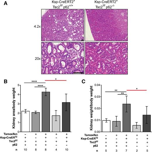 Figure 2. p62 promotes kidney cystogenesis and tumorigenesis in Tsc2f/f CAGGCreERT2+ mice. A, Mice were treated with tamoxifen 63 mg/kg every other day for 5 days at 8–10 weeks and sacrificed 4 months later. Representative H&E images of Tsc2f/f CAGGCreERT2+ p62+/+ and Tsc2f/f CAGGCreERT2+ p62−/− kidneys. Scale bar, 100 μm. B, Kidney areas were normalized to body weight. C, Kidney weights were normalized to body weight. n, number of kidneys analyzed. Data presented as the mean ± 95% CI with *, P < 0.05; **, P < 0.01; ****, P < 0.0001.