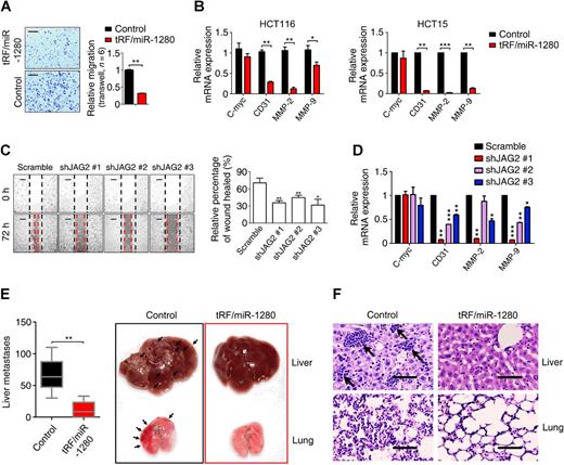 Figure 4. tRF/miR-1280 inhibits premetastatic features of colorectal cancer cells. A, Transwell cell migration assay in HCT116 cells infected with tRF/miR-1280 expression or control vector. Scale bars, 150 μm. B, mRNA expression of C-myc, CD31, MMP-2, and MMP-9 in HCT116 and HCT15 cells with tRF/miR-1280 expression or control vector. C, Cell migration. HCT116 JAG2-knockdown cells and scramble HCT116 cells. D, mRNA expression of C-myc, CD31, MMP-2, and MMP-9 in JAG2-knockdown or scramble HCT116 cells. E, The number of liver metastases after intrasplenic injection with HCT1116 cells infected with tRF/miR-1280 expression or control vector. F, Representative hematoxylin and eosin stain of liver and lung metastasis after intrasplenic injection with HCT1116 cells infected with tRF/miR-1280 expression or control vector. Scale bars, 100 μm. *, P < 0.05; **, P < 0.01; ***, P < 0.001.