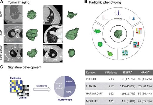 Figure 1. Analysis workflow. A, Examples of lung adenocarcinomas tumors imaged with CT imaging (left) and segmented in 3D (right). B, Quantification of the tumor phenotype using radiomics feature algorithms. C, Radiomic and clinical data were used to develop signatures for EGFR and KRAS mutation status from four independent datasets to investigate associations between the radiomic features and somatic mutations in lung adenocarcinomas. Details on the patient and tumor characteristics of these cohorts are shown in Supplementary Table S1 and Supplementary Data S1.