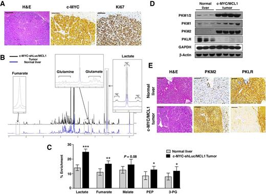 Figure 1. c-MYC–induced liver tumorigenesis is associated with increased glycolysis and a switch from PKL to PKM. A, Immunohistochemical patterns of c-MYC and Ki67 in c-MYC/MCL1 tumors. Scale bars, 100 μm. B, Representative 1H-NMR spectra from extracts of normal livers (blue) and c-MYC/MCL1 liver tumors (black) of mice injected with a bolus of 13C-glucose. Regions of interest are magnified to show increased pools of glutamate, fumarate, and lactate and decreased pool of glutamine in tumors in comparison with normal tissue. Increased 13C incorporation into lactate is denoted by the 13C satellites of the H3-lactate. C, Percentage of enrichment from 13C6-glucose in glycolytic and Krebs cycle intermediates measured by GC-MS. Data are presented as mean ± SD. Student t test was used; *, P < 0.05, **, P < 0.01, ***, P < 0.001. D, PKM1/2 and PKLR protein levels measured in whole-tissue lysates from normal and tumor samples by immunoblotting using β-actin and GAPDH as a loading control. E, Expression of PKM2 and PKLR examined by IHC in normal livers and c-MYC/MCL1 liver tumors. Scale bars, 100 μm.