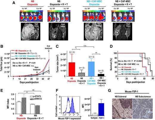Figure 7. Combined inhibition of STAT3 and ERK1/2 sensitizes neuroblastoma (NB) cells to chemotherapy in xenograft model. A, Representative bioluminescence images of NSG mice at day 47 after subrenal capsule injection with CHLA-255-FLuc cells alone or mixed with CAF-MSC (ratio 4:1). After 5 weeks, mice were treated either with etoposide (10 mg/kg, three times/week) or etoposide and a combination of ruxolitinib (R; 60 mg/kg/twice a day) and trametinib (T; 3 mg/kg/day) for 2 weeks. Bottom, representative MRI images of the tumors at day 49. B, Average bioluminescence signal intensity (p/s, photons/second) over time of all mice (±SD) in each group. C, Average tumor size (±SD) measured by MRI at day 49. D, Kaplan–Meier survival curves in each group of mice. E, Flow cytometry analysis for p-STAT3 and p-ERK1/2 in GD2-positive neuroblastoma cells harvested from tumors 5 hours after treatment with R and T. The data represent the MFI from two tumors in each group. F, Flow cytometry analysis of mFSP-1 expression in tumors derived from the injection of neuroblastoma cells alone. Left, open curve represents the isotype control, and the filled curve represents mFSP-1 staining; right, the histogram represents the MFI (±SD) from three tumors. G, Representative images of sections of tumors derived from injection of neuroblastoma cells alone under the renal capsule or subcutaneously and stained for mouse FSP-1 as described in Materials and Methods. Scale bar, 50 μm (in the main picture) and 20 μm (in inset). *, P < 0.05; **, P < 0.01; n.s., not significant.