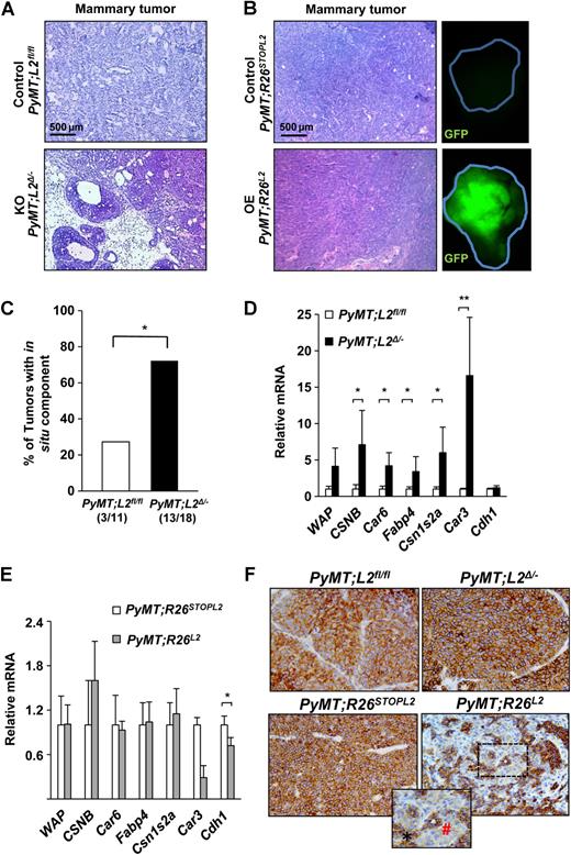 Figure 1. Loxl2 promotes PyMT tumor epithelial dedifferentiation and local invasion. A and B, Representative hematoxylin and eosin images of paraffin-embedded tumors from PyMT;L2Δ/− and PyMT;R26L2 16-week-old mice and their respective controls. In the case of the overexpression model (B), representative GFP images of primary tumors are also shown (right). Scale bars, 500 μm. C, Percentage of primary breast tumors containing regions of in situ carcinoma developed by PyMT;Loxl2fl/fl and PyMT;L2Δ/− mice. The number of tumors with in situ component over the total number of analyzed tumors from reach genotype is shown at the bottom; *, P < 0.05 (Fisher exact test). D and E, Primary tumors of 14-week-old PyMT;L2Δ/−(D) and PyMT;R26L2 (E) mice and their paired controls (n = 5, each) were subjected to RT-qPCR analyses for the indicated differentiation markers. Error bars, SE. *, P < 0.05; **, 0.001 < P < 0.005 (Student t test; unpaired, two-tailed). F, Representative E-cadherin IHC images in PyMT tumors with modified Loxl2 expression: PyMT;L2Δ/−(top right) and PyMT;R26L2 (bottom right) as well as in their specific controls PyMT;L2fl/fl (top left) and PyMT;R26STOPL2 (bottom left), respectively; magnification, ×20. Inset shows a specific heterogeneous staining area with conserved (*, black) and reduced (#, red) E-cadherin in one representative PyMT;R26L2 tumor; magnification, ×40.
