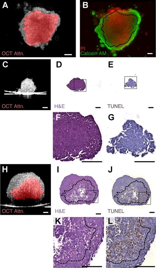 Optical Coherence Tomography Detects Necrotic Regions and ...