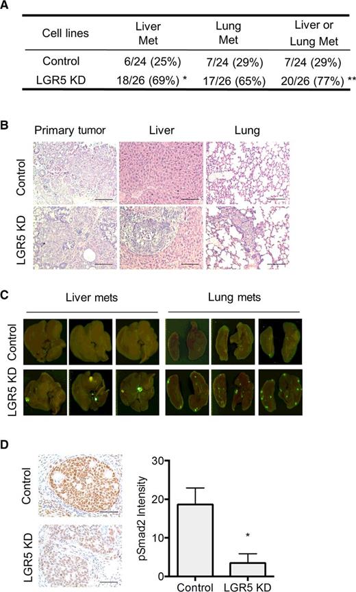 Figure 4. LGR5 suppresses colon cancer metastasis in vivo. A, Control and LGR5 knockdown CBS cells were orthotopically implanted into athymic nude mice. The incidence of liver and/or lung metastasis is shown. *, P < 0.05; **, P < 0.01 with power >80%. B, Representative images of H&E staining in primary tumors, liver, and lung metastases are shown. Scale bars, 200 μm. C, Representative GFP images of liver and lung metastases are shown. D, IHC staining of phosphorylated Smad2 was performed in primary tumors. Representative images are shown (left). The intensity of pSmad2 staining was quantified (right). Scale bars, 100 μm. The data are presented as the mean ± SEM. *, P < 0.05.