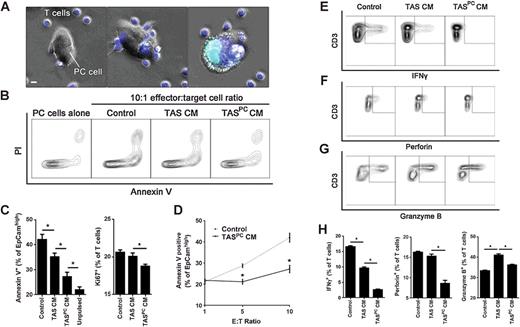 Figure 7. The stromal innate immune response to pancreatic cancer suppresses antitumor T-cell—mediated lymphotoxicity. A, Transgenic HLA-A2, MART1-specific CD8 T cells were labeled with CellTracker Blue (blue) and cocultured with MART1-pulsed primary pancreatic cancer cells in the presence of SYTOX Green (green). Representative images of cocultures are displayed. Scale bar, 5 μm. B, Representative contour plots evaluating apoptosis at 24 hours in EpCamhigh pancreatic cancer cells using Annexin V and propidium iodide (PI) stains. C, Quantification of Annexin-positive apoptotic cancer cells (left) and Ki67-positive proliferating CD8+ T cells (right) under each indicated condition at a 10:1 effector:target (E:T) cell ratio. Unpulsed cells indicate the absence of exogenous MART1 peptide and thus served as a negative control. D, Pancreatic cancer cell apoptosis was evaluated at the indicated E:T cell ratios for both control and PCCM-stimulated TAS CM (TASPC CM) conditions. Representative contour plots of IFNγ (E), perforin (F), and granzyme B (G) expression in T cells as well as quantification of each population for the indicated conditions at a 10:1 E:T ratio (H). Bars, mean ± SEM. *, P < 0.05 using the independent samples t test.