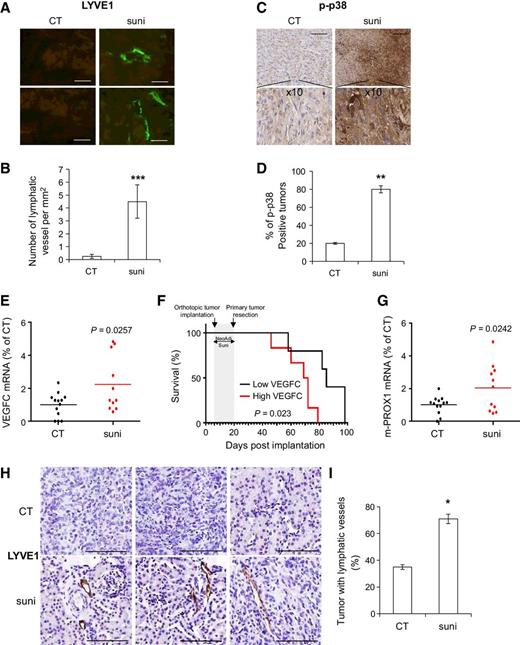Figure 6. Sunitinib induced lymphangiogenesis in vivo. A–E, Experimental tumors obtained after subcutaneous injection of 5 × 106 786-O cells were analyzed for LYVE1 expression. A, Lymphatic endothelial cells were detected by LYVE1 immunolabeling (green). Scale bar, 20 μm. B, Quantification of the LYVE1-positive vessels per mm2 (n = 20). C, p-p38 was detected by IHC. Scale bar, 20 μm. D, Quantification of p-p38–labeled cells (n = 20). E–I, SN12‐PM6LUC+ (2 × 106 cells) were implanted into the kidney (subcapsular space) of 6‐ to 8-week-old female CB‐17 SCID. E, VEGFC mRNA mRNA levels in tumors from control mice and mice treated in a neoadjuvant setting (n = 24). F, The Kaplan–Meier analysis of mice treated or not with sunitinib and the prognostic role of VEGFC mRNA levels (n = 24). G, PROX1 mRNA levels in tumors from control mice and mice treated in a neoadjuvant setting (n = 24). H, Lymphatic endothelial cells were detected by LYVE1 IHC. Scale bar, 20 μm. I, Quantification of the LYVE1-positive vessels (n = 24). *, P < 0.05; **, P < 0.01; ***, P < 0.001.