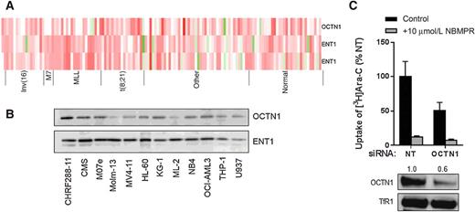 Figure 4. Influence of OCTN1 on cytarabine uptake in AML cells. A, Gene expression of OCTN1 and ENT1 (two probe sets) in primary AML blast samples from pediatric patients used in the survival analysis shown in Fig. 1A and B, as determined by microarray analysis. Each column represents an individual primary sample, and columns are categorized by cytogenetic AML subtypes of prognostic relevance. B, Protein expression of OCTN1 in a panel of 12 AML cell lines. C, Cellular uptake of cytarabine (Ara-C; 1 μmol/L; 5-minute uptake) with or without NBMPR preincubation was measured in OCI-AML3 cells, 48 hours after transfection with a nontargeting (NT) control siRNA or a siRNA-targeting OCTN1. Results are shown as cytarabine uptake as compared with cells transfected with NT siRNA. Data are representative of two independent experiments done in triplicate. OCTN1 protein expression was determined by Western blot analysis from membrane extraction of OCI-AML3 cells 48 hours posttransfection, and the transferrin receptor served as loading control. The relative expression difference of OCTN1 after RNAi is indicated by the numbers above the lanes.