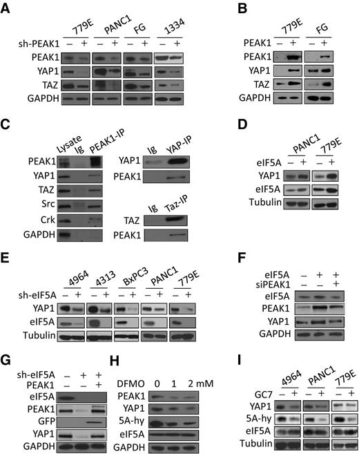 Figure 2. PEAK1 associates with and regulates YAP1/TAZ protein levels in PDAC cells. A, The indicated PDAC cells lines were depleted of PEAK1 using shPEAK1 (+) or control shRNAs (-) and were Western blotted for the indicated proteins. GAPDH served as a loading control. B, The indicated cell lines were infected with lentiviruses encoding GFP-PEAK1 (+) or control viruses (-) and were Western blotted as in A. C, Protein lysates were prepared from FG cells and were Western blotted for the indicated proteins. Also, PEAK1, YAP1, or TAZ were immunoprecipitated (IP) and then Western blotted for the indicated proteins. Immunoglobulin-coupled beads (Ig) served as a control. D, The indicated cell lines were infected with lentiviruses encoding eIF5A (+) or control lentivirus (-) and were Western blotted for the indicated proteins. Tubulin served as a loading control. E, The indicated cells were depleted of eIF5A using shRNAs to eIF5A (+) or control shRNAs (-) and were Western blotted for the indicated proteins. F, eIF5A-expressing cells as in D were depleted of PEAK1 protein using siRNA (+) or control siRNAs (-) and were Western blotted for the indicated proteins. G, eIF5A knockdown cells as in E were infected with lentiviruses encoding PEAK1 (+) or control viruses (-) and were Western blotted for the indicated proteins. H, FG cells were treated with the 1 or 2 mM DFMO or vehicle (0) for 48 hours, and then lysed and Western blotted for the indicated proteins. 5A-hy, hypusine-modified eIF5A, which was detected with a eIF5A-hypusine–specific antibody. I, The indicated cell lines were treated with 20 μmol/L GC7 or vehicle (0) for 48 hours, and then lysed and Western blotted for the indicated proteins.