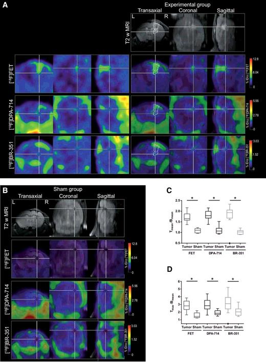 Figure 1. Multitracer approach to characterize the glioma microenvironment. A, PET images for [18F]FET, [18F]DPA-714, and [18F]BR-351 (left, top to bottom) and their fusion with T2w MRI (right, top to bottom). The dotted line indicates the tumor area depicted by MRI and was transferred to PET images. B, Representative fusion images of sham-operated animals. C, Tmean/Bmean ratios showed significantly increased uptake for [18F]DPA-714, [18F]BR-351, and [18F]FET. D, Investigation of Tmax/Bmean ratios.