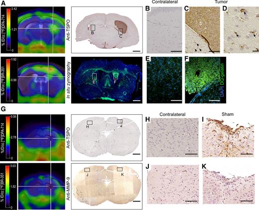 Figure 3. Spatial comparison of [18F]DPA-714 and [18F]BR-351 with histology and in situ zymography. A, Comparison of PET data with histology for TSPO and in situ zymography revealed good spatial agreement with the respective PET signal. B–F, TSPO and MMP signal coming from the tumor cells and surrounding tissue (TSPO, arrows). G–K, Sham-operated animals/brains displayed no tracer uptake. Slight immunoreactivity was observed for TSPO along the injection tract (Scale bar, 1,000 μm overview scans; 100/10 μm higher magnification images).