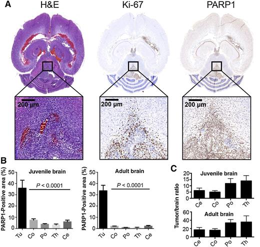 Figure 2. PARP1 is overexpressed in RCAS-based murine DIPG mouse models. A, Immunohistochemical staining of formalin-fixed, paraffin-embedded tumor-bearing brains following tumor generation in ntv-a/p53fl/fl mice injected with DF1 cells (transfected with RCAS-PDGFB, RCAS-Cre) in the brainstem at 2–4 days of age or right hemisphere at 4–6 weeks of age (Supplementary Fig. S1C). Anti-PARP1, anti-Ki67 (proliferation), and H&E staining for morphological evaluation were carried out on adjacent sections. B, Quantification of PARP1 staining in juvenile and adult tumor-bearing mice to calculate the relative PARP1-positive area in relation to the entire tissue area. ROIs were placed on tumor (Tu) regions and anatomically defined brain regions (Co, cortex; Po, pons; Ce, cerebellum; Th, thalamus; n ≥ 3 animals/4–7 ROIs per region; data represented as mean ± standard error). Statistical significance was determined using an unpaired Student t test, corrected for multiple comparisons by the Holm–Sidak method with an alpha of 0.01. Automated analysis based on color thresholding was carried out using Metamorph Software. C, Tumor-to-brain-area ratios are displayed as mean values ± standard error. N = 4 animals for the juvenile brain; n = 3 for the adult brain.