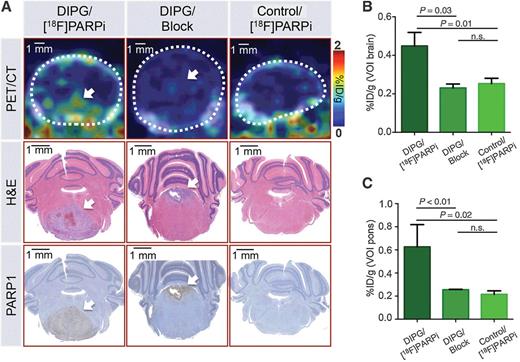 Figure 4. Specificity of [18F]PARPi tumor uptake was confirmed by blocking with olaparib. In vivo PET/CT imaging and quantification of [18F]PARPi in juvenile brainstem tumor-bearing mice (ntv-a/p53fl/fl mice injected with transfected DF1 cells RCAS-PDGFB and RCAS-Cre in the brainstem at 2–4 days of age). [18F]PARPi was intravenously injected in tumor-bearing (DIPG) or healthy mice (control); to control for specificity, 1 mg olaparib was injected 30 minutes before [18F]PARPi (Block) to occupy specific binding sites (n = 3/group). After imaging, intracardiac perfusion with 4% PFA was carried out and brains were conserved for histology. A, Representative PET/CT images of the brainstem region compared with H&E and PARP1 staining of the same animals. B, Quantification of %ID/g of the entire brain was derived from the PET/CT data set using the CT as reference for creating VOIs. C, Similarly, the %ID/g was analyzed for the brainstem region using the CT as reference for creating VOIs. Statistical significance was determined using an unpaired Student t test assuming equal SD. White arrow, tumor location.