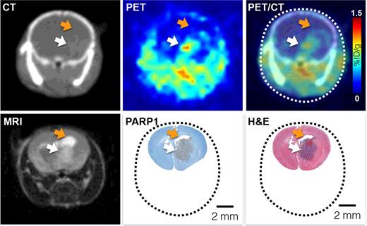 Figure 5. [18F]PARPi accurately delineates tumors in vivo. To evaluate the ability and quality of [18F]PARPi to delineate brain tumors in vivo, we compared [18F]PARPi PET/CT imaging with MRI and histology. Top (left to right): CT, PET, and PET/CT 1 hour p.i. of [18F]PARPi. Bottom (left to right): T2-weighted 1.05T MRI image, PARP1 IHC (brown staining), and H&E. All images are from the same animal. PET/CT and MRI were conducted on the same day and the animal was sacrificed immediately after MRI to preserve the brain for histology. White arrow, tumor location. Orange arrow, an accumulation of cerebrospinal fluid, which causes a strong MRI signal, but is not seen in [18F]PARPi imaging.