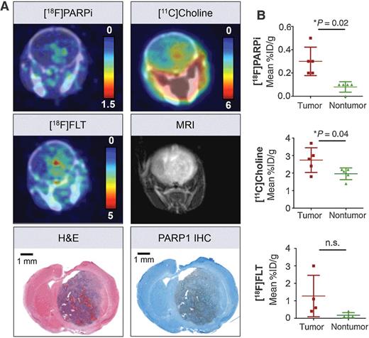 Figure 6. Comparison of [18F]PARPi with [11C]Choline and [18F]FLT imaging. A, Representative PET/CT images of the same tumor-bearing animal (adult model, right hemisphere) using [18F]PARPi (2 hours p.i.), [11C]Choline (5 minutes p.i.), [18F]FLT (2 h p.i.), and MRI (T2 weighted) compared with PARP1 IHC and H&E histology. [18F]FLT and MRI were conducted 48 hours after the [18F]PARPi and [11C]Choline imaging. Calibration bar represents %ID/g. B, Quantification of the mean %ID/g of a VOI in the tumor area compared with a control area in the back region of the brain. Statistical significance was determined using a paired t test.