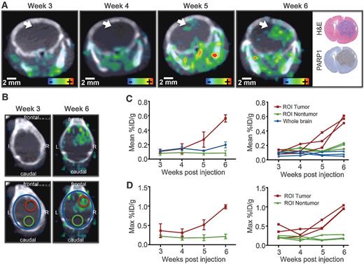 Figure 7. Tumor growth monitoring is feasible using [18F]PARPi. A, Tumor development was followed over the course of 6 weeks using ntv-a;p53fl/fl mice injected with DF1 cells in the right hemisphere at 4- to 6-weeks-old (n = 4 total, n = 3 that showed tumor growth displayed in figure). In the displayed example the white arrow indicates tumor location. For weekly PET/CT imaging, animals were injected with 100–200 μCi [18F]PARPi 2 hours before PET/CT imaging. H&E and PARP1 histology were conducted after the last imaging time point. B, To quantify uptake, VOIs were created in the tumor region and control region using the PET/CT and histologically confirmed tumor location. These were then applied to earlier imaging time points. Mean (C) and max (D) %ID/g were quantified between week 3 and 6 post-tumor inoculation. One animal showed no tumor development and was histologically confirmed to have no tumor (Supplementary Fig. S7B).