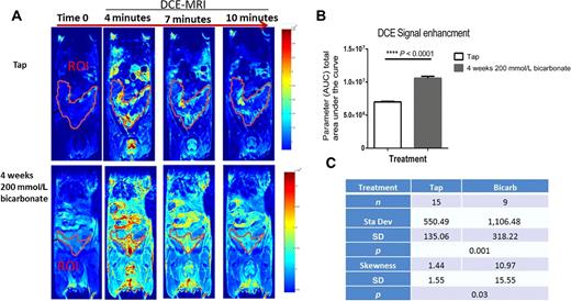 Figure 2. Effect of bicarbonate on perfusion in TRAMP. A–C, Tumor vasculature (perfusion and permeability) was assessed using gadolinium-based dynamic contrast-enhanced (DCE)-MRI, A, Representative images of DCE-MRI images in coronal plane of the TRAMP prostate tumor in the tap group and 200 mmol/L bicarbonate group are shown. Images were obtained at time 0 (prior to gadolinium injections) and at 4, 7, and 10 minutes post-gadolinium injections. The color scale represents incremental increase in signal intensity in the prostate. B, Data analysis for initial AUC of the signal intensity was performed using MATLAB, showing higher blood flow in the 200 mmol/L bicarbonate-treated group (****, P < 0.0001). C, Statistical analyses of enhancement at 10 minutes, showing mean signal intensity ± SD, as well as the skewness of the histogram of enhancement values ± SD. The mean values indicate significantly increased enhancement (P = 0.001) in the treated compared with the tap controls. Furthermore, the enhancing pixels in the tap group were more normally distributed, compared with the bicarbonate group (P = 0.03), which we interpret as recruitment of new vasculature that is skewed toward higher perfusion values. Two-tailed Student t tests were used to calculate statistical significance.