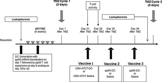 Figure 1. Trial design. As per the clinical standard of care, patients underwent surgical resection and received xRT with concurrent temozolomide (75 mg/m2) over a 6-week period. Three to 4 weeks after xRT/TMZ, patients received cycle 1 of a temozolomide (200 mg/m2/day) daily for 5 days starting on day 1. Leukapheresis was performed prior to chemoradiation. DC generation began at leukapheresis, followed by pp65 mRNA transfection on day 7 of culture. Expansion of T cells began on day 8, ending on day 35 to 42. On day 21, patients received CMV pp65-specific T cells with either CMV pp65 RNA-loaded DCs or saline by random assignment. T-cell activity was measured before vaccine 1 on day 21 and 7 days after vaccine 1 at day 28. A total of three CMV pp65-loaded DC or saline infusions was administered in 14-day intervals. All patients underwent leukapheresis after day 49 and then received a cycle of temozolomide every 28 days for at least 6 cycles. Imaging was performed bimonthly, and upon tumor progression, suitable participants underwent stereotactic biopsy or resection as standard of care. Patients were followed until death.