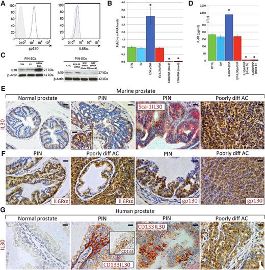 Figure 1. Expression of IL30 and IL30R by PCSLCs, murine, and human prostate tissues. A, Cytofluorimetric analyses of gp130-(CD130) and IL6Rα- (CD126) expression in PIN-SCs. B, Relative expression ± SD of IL30 mRNA. CTRL, PIN-SCs. ANOVA, P < 0.0001. *, P < 0.01, Tukey HSD test compared with CTRL, EV, or EV-IL30shRNA (clones D and B). C, Western blot analyses of IL30 protein expression. D, ELISA assay of IL30 release by CTRL (182.82 ± 6.9 pg/mL), EV-PIN-SCs (168.21 ± 10.82 pg/mL), IL30PIN-SCs (2424.46 ± 83.9 pg/mL), EV-IL30shPIN-SCs (170.44 ± 13.09 pg/mL), and IL30shPIN-SCs (clone D, 6.76 ± 1.87 pg/mL; clone B, 7.53 ± 1.38 pg/mL). ANOVA, P < 0.0001. *, P < 0.01, Tukey HSD test compared with CTRL, EV, or EV-IL30shRNA (clones D and B). E, IL30 immunostaining in normal prostate, PIN (11 weeks), and in poorly differentiated tumor (28 weeks) of TRAMP mice. IL30 (brown) colocalizes with Sca-1 (red) in PIN; scale bars, 50 μm (left two); 30 μm (right two and inset). F, Expression of IL6Rα and gp130 in PIN and in poorly differentiated adenocarcinoma (AC) of TRAMP mice; scale bars, 50 μm (left two); 30 μm (right two). G, IL30 immunostaining in normal prostate, PIN (IL30/CD133 colocalization), and in poorly differentiated adenocarcinoma; scale bars, 20 μm (left two and inset); 30 μm (right two).