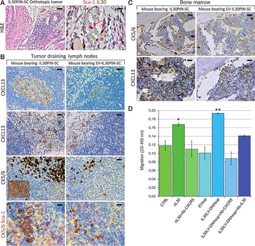 Figure 6. IL30 promotes PCSLC dissemination in the LNs and bone marrow involving CXCR5/CXCL13 upregulation. A, Histology and immunohistochemistry of IL30PIN-SC orthotopic tumors. Isolated Sca-1+/IL30+ cells (red arrow) inside the blood vessels; scale bars, 50 μm (left); 20 μm (right). B, Immunohistochemistry of LNs draining IL30PIN-SC or EV-IL30PIN-SC orthotopic tumors. The inset shows CK5/6 staining of the primary tumor. In LNs, CK5/6+ colocalizes with Sca-1; scale bars, 30 μm; 20 μm (bottom). C, Immunohistochemistry of bone marrow from mice bearing IL30PIN-SC and PIN-SC orthotopic tumors; scale bars, 50 μm (top); 30 μm (bottom). D, Migration of IL30–treated PIN-SCs toward CXCL13. Results are expressed as mean ± SD. ANOVA, P < 0.0001. *, Tukey HSD test compared with CTRL and rIL30+Ab-CXCR5 (P < 0.05) or EVsup and IL30LV-DNAsup+Ab-CXCR5 (P < 0.01). **, Tukey HSD test compared with CTRL, rIL30+Ab-CXCR5, EVsup, and IL30LV-DNAsup+Ab-CXCR5 (P < 0.01) or IL30LV-DNAsup (P < 0.05).