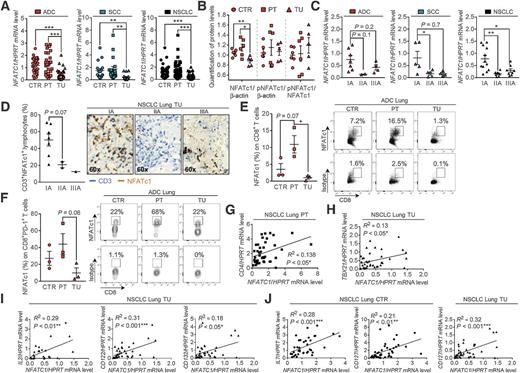 Figure 1. Loss of NFATC1 correlates with poor prognosis of patients with NSCLC. A, qPCR based analysis of NFATC1 mRNA expression in lung tissue samples from the tumoral (TU), peritumoral (PT), and control (CTR) region of patients suffering from ADC (NCTR = 30, NPT = 25, NTU = 26) or SCC (NCTR = 17, NPT = 18, NTU = 18) collectively grouped as NSCLC (NCTR = 47, NPT = 43, NTU = 44). B, Quantitative Western blot analysis of total NFATc1/β-actin, pNFATc1/β-actin, and pNFATc1/NFATc1 protein levels in the CTR, PT, and TU area of patients with ADC (NCTR = 6, NPT = 6, NTU = 5). C, Expression analysis of NFATC1 mRNA in the TU region of patients with ADC (IA, NTU = 7; IIA, NTU = 2; IIIA, NTU = 4), patients with SCC (IA, NTU = 5; IIA, NTU = 5; IIIA, NTU = 4), and total patients with NSCLC (IA, NTU = 12; IIA, NTU = 7; IIIA, NTU = 8) classified according to the TNM staging system. D, Double IHC for NFATc1 (brown) and CD3 (blue) on lung tissue array in the TU region of patients with NSCLC classified according to the TNM staging system (IA, NTU = 7; IIA, NTU = 2; IIIA, NTU = 1; magnification, ×60). E and F, Flow cytometry analyses of NFATc1 in CD8+ T cells (%; E), and NFATc1 in PD-1+CD8+ T cells (%) in total lung cell suspension of the CTR, PT, and TU region of patients with ADC (ADC: NCTR = 3, NPT = 3, NTU = 3; F). G and H, Correlation between lung NFATC1 and CD4 (NPT = 41) expression in the PT region; TBX21 (NTU = 38) expression in the TU region (G); IL2 (NTU = 23), CD122 (NTU = 36), and CD132 (NTU = 35) expression in the TU region (H); IL7 (NCTR = 37), CD127 (NCTR = 41) expression in the CTR region and CD127 (NTU = 40) expression in the TU region (I) from patients with NSCLC (J). N values are given per group. Data are shown as mean values ± SEM using Student two-tailed t test. *, P < 0.05; **, P < 0.01; ***, P < 0.001.