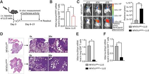 Figure 3. Targeted deletion of Nfatc1 in T cells causes severe lung tumor development. A, Experimental design for the induction of lung adenocarcinoma development in mice. Tumor growth was induced via intravenous (i.v.) injection of LL/2-luc-M38 (LL/2) lung carcinoma cells. Tumor load was measured using an in vivo bioluminescence–based imaging system. The experiment ended on day 16 to 21. B, qPCR-based analysis of Nfatc1alpha mRNA expression in isolated lung CD4+ T cells of naïve and tumor-bearing wild-type mice (LL/2; Nnaïve = 5, NLL/2 = 5). C, Representative in vivo images of lung tumor load analysis in NFATc1fl/fl control littermates (NFATc1fl/fl + LL/2) and NFATc1ΔCD4 (NFATc1ΔCD4 + LL/2) mice (left). Radiance (photon flux/second) of the last day of three independent experiments is summarized (right), (NNFATc1fl/fl+LL/2 = 13, NNFATc1ΔCD4+LL/2 = 14). D, Representative hematoxylin and eosin staining of the lung of a NFATc1fl/fl and NFATc1ΔCD4 mouse. E, qPCR-based analysis of exon 3 of Nfatc1 (Nfatc1ex3) in isolated lung CD8+ T cells of tumor-bearing NFATc1fl/fl and NFATc1ΔCD4 mice (NNFATc1fl/fl+LL/2 = 4, NNFATc1ΔCD4+LL/2 = 3). F, qPCR-based analysis of Nfatc1ex3 mRNA expression in isolated CD4+ T cells from the spleen of lung tumor-bearing NFATc1fl/fl and NFATc1ΔCD4 mice (NNFATc1fl/fl+LL/2 = 3, NNFATc1ΔCD4+LL/2 = 2). N values are given per group. Data are shown as mean values ± SEM using Student two-tailed t test. *, P < 0.05; **, P < 0.01; ***, P < 0.001.