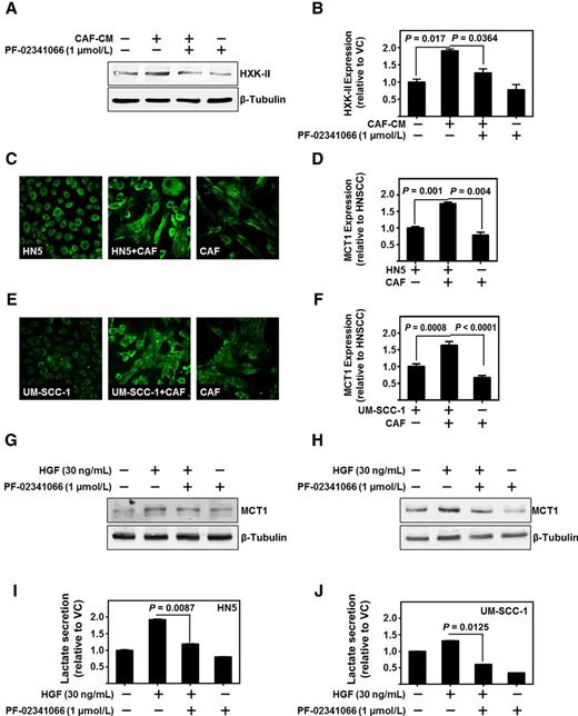 Figure 2. CAF-secreted HGF regulates HNSCC glycolytic enzymes and lactate production. A and B, Representative immunoblot of hexokinase-II (HXK-II) protein levels of HN5 treated with CAF-CM and/or c-MET inhibitor, PF-02341066 (1 μmol/L). β-Tubulin served as loading control. Cumulative densitometric analysis of hexokinase-II/β-tubulin normalized to vehicle control-treated lane. C and D, Representative immunofluorescent image (magnification, ×200) of MCT1 (green) on HN5, CAFs, or coculture of HN5 and CAFs. Number of cells kept constant between wells. MCT1 levels were assessed as total fluorescent intensity and cumulative results. E and F, Representative immunofluorescent image (magnification, ×200) of MCT1 (green) on UM-SCC-1, CAFs, or coculture. Number of cells kept constant between wells. MCT1 levels were assessed as total fluorescent intensity and cumulative results. G, Representative immunoblot of MCT1 protein levels expressed in HN5 with treatment of recombinant HGF (30 ng/mL) and/or PF-02341066 (1 μmol/L). β-Tubulin served as loading control. H, Representative immunoblot of MCT1 protein levels expressed in UM-SCC-1 with treatment of recombinant HGF (30 ng/mL) and/or PF-02341066 (1 μmol/L). β-Tubulin served as loading control. I, Lactate secretion as assessed by enzymatic based absorbance assay of HN5 treated with HGF (30 ng/mL) and/or PF-02341066 (1 μmol/L). Data represent cumulative normalized to vehicle control-treated cells. J, Lactate secretion as assessed by enzymatic based absorbance assay of HN5 treated with HGF (30 ng/mL) and/or PF-02341066 (1 μmol/L). Data represent cumulative results normalized to vehicle control-treated cells. Error bars, ± SEM.