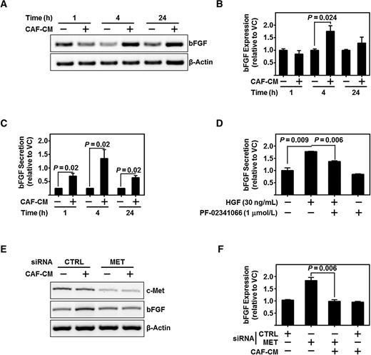 Figure 3. c-Met regulates bFGF expression in HNSCC. A and B, Representative PCR product of bFGF mRNA in UM-SCC-1 treated with CAF-CM for the indicated time points. β-Actin served as loading control. Graph depicts cumulative densitometric results of three independent experiments of bFGF/β-actin normalized to vehicle control-treated cells at each time point. C, Graph depicts ELISA protein assessment of bFGF secreted from HN5 exposed to three different CAF-CMs. Cumulative data from three independent experiments are normalized to vehicle-treated cells at each time point. D, Graph depicts ELISA protein assessment of bFGF secreted from UM-SCC-1 exposed to either HGF (30 ng/mL) and/or c-MET inhibitor, PF-02341066 (1 μmol/L). Cumulative data from three independent experiments are normalized to vehicle-treated cells. E and F, Representative PCR product of c-MET, bFGF, or β-actin (as loading control) mRNA in UM-SCC-1 exposed to CAF-CM with either control siRNA (CTRL) or c-Met siRNA. Cumulative results from three independent experiments of bFGF/β-actin normalized to CTRL siRNA, vehicle-treated UM-SCC-1. Error bars, ± SEM.