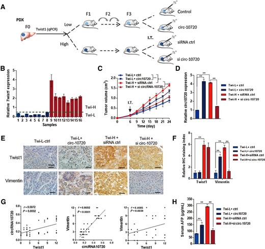 Figure 4. Intratumoral silencing of circ-10720 blocks the promotive effect of Twist1 mediated on vimentin expression in a patient-derived xenograft (PDX) model of HCC. A, Schematic of intratumoral circ-10720 or silencing of circ-10720 in the PDX model. B, Twist1 expression levels in 16 fresh HCC tumor samples were measured with qRT-PCR, and the tumor samples were divided into two groups, namely, Twist1-Low (Twi-L) and Twist1-High (Twi-H) groups. C, Tumor growth curve of Twi-L + control, Twi-L + circ-10720, Twi-H + siRNA control, and Twi-H + si-circ-10720 groups. Tumor volume was monitored every 3 days for 24 days. Each point represents the mean ± SD for different animal measurements (n = 4). *, P < 0.05; **, P < 0.01, one-way ANOVA. D, qRT-PCR analysis of circ-10720 levels in tumor tissues of Twi-L + control, Twi-L + circ-10720, Twi-H + siRNA control, and Twi-H + si-circ-10720 groups. Each bar represents the mean ± SD for triplicate measurements of four xenografts in each group. **, P < 0.01, one-way ANOVA. E and F, Twist1 and vimentin expression in the tumor tissues of Twi-L + control, Twi-L + circ-10720, Twi-H + siRNA control, and Twi-H + si-circ-10720 groups were analyzed via IHC. Each bar represents the mean ± SD for triplicate measurements of four xenografts in each group. **, P < 0.01, one-way ANOVA. G, Correlation analysis between Twist1 and circ-10720 (P = 0.0002), circ-10720 and vimentin (P < 0.0001), and Twist1 and vimentin (P = 0.0039). The points represent the triplicate measurements of four xenografts in every group. H, AFP was detected by ELISA after intratumoral injection of circ-10720 and si-circ-10720 for 18 days. **, P < 0.01, one-way ANOVA. Each bar represents the mean ± SD for triplicate measurements of four xenografts in each group.